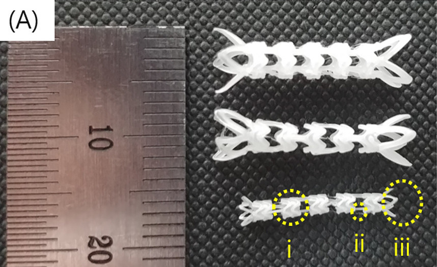 POSTECH scientists 3D print stents to combat radiation-induced espophigitis in cancer patients 