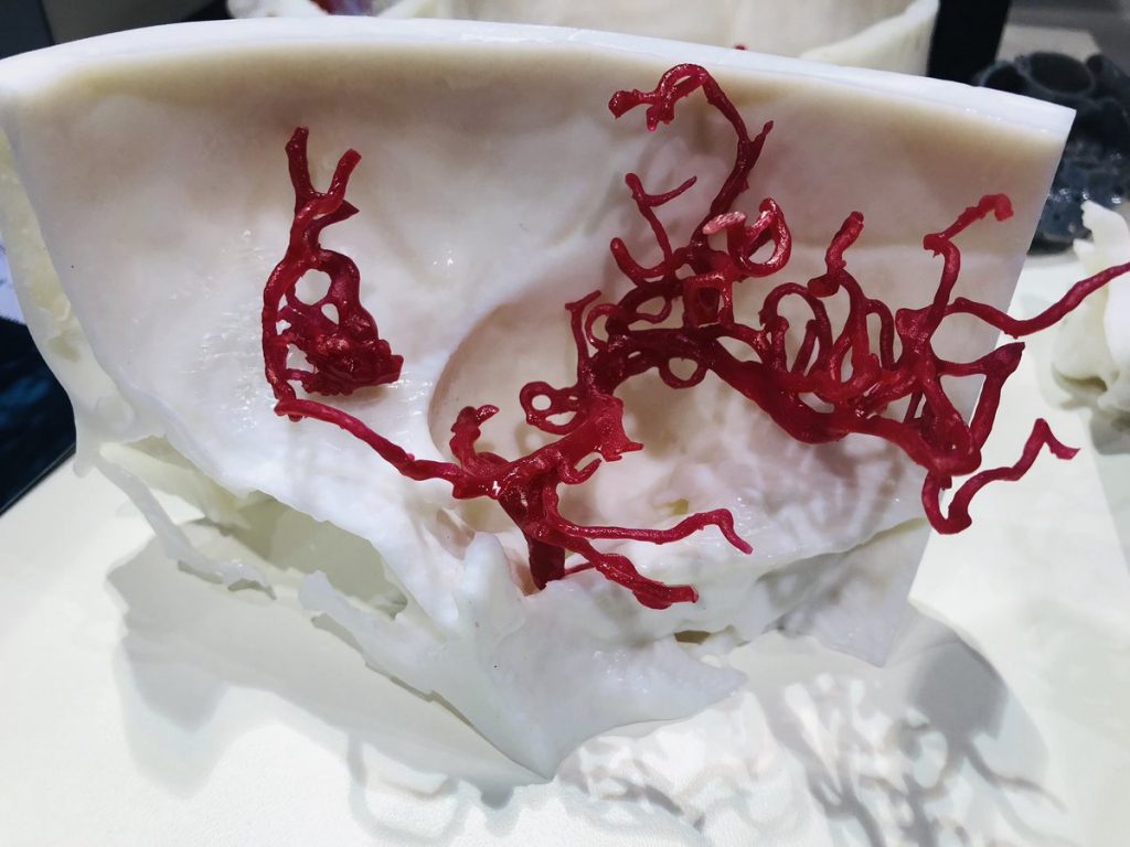 NHS Hospitals in Northeast England Become Latest Beneficiaries of a 3D Printing Lab