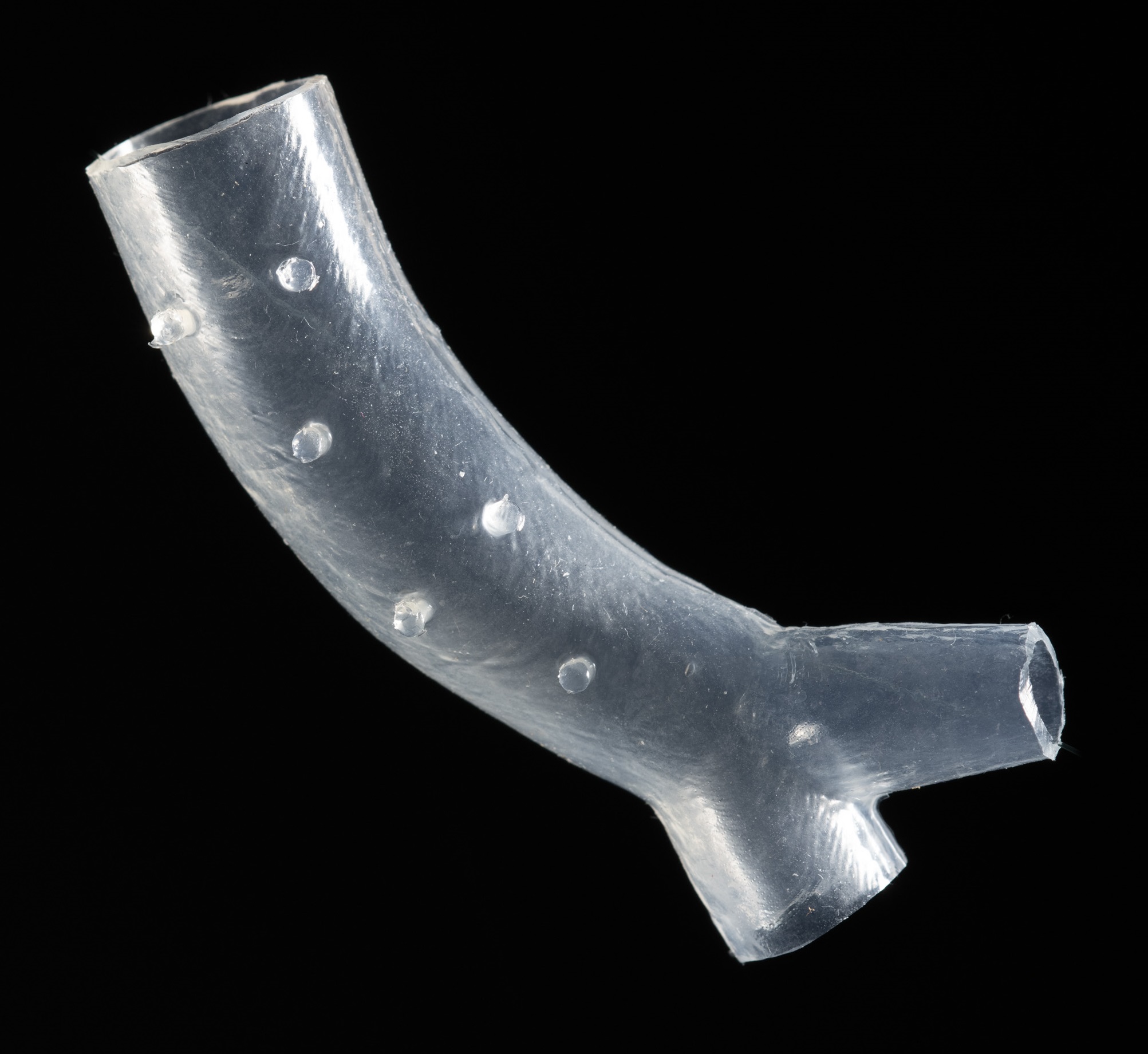 3D Printed Patient-specific Airway Stents Receive FDA Approval
