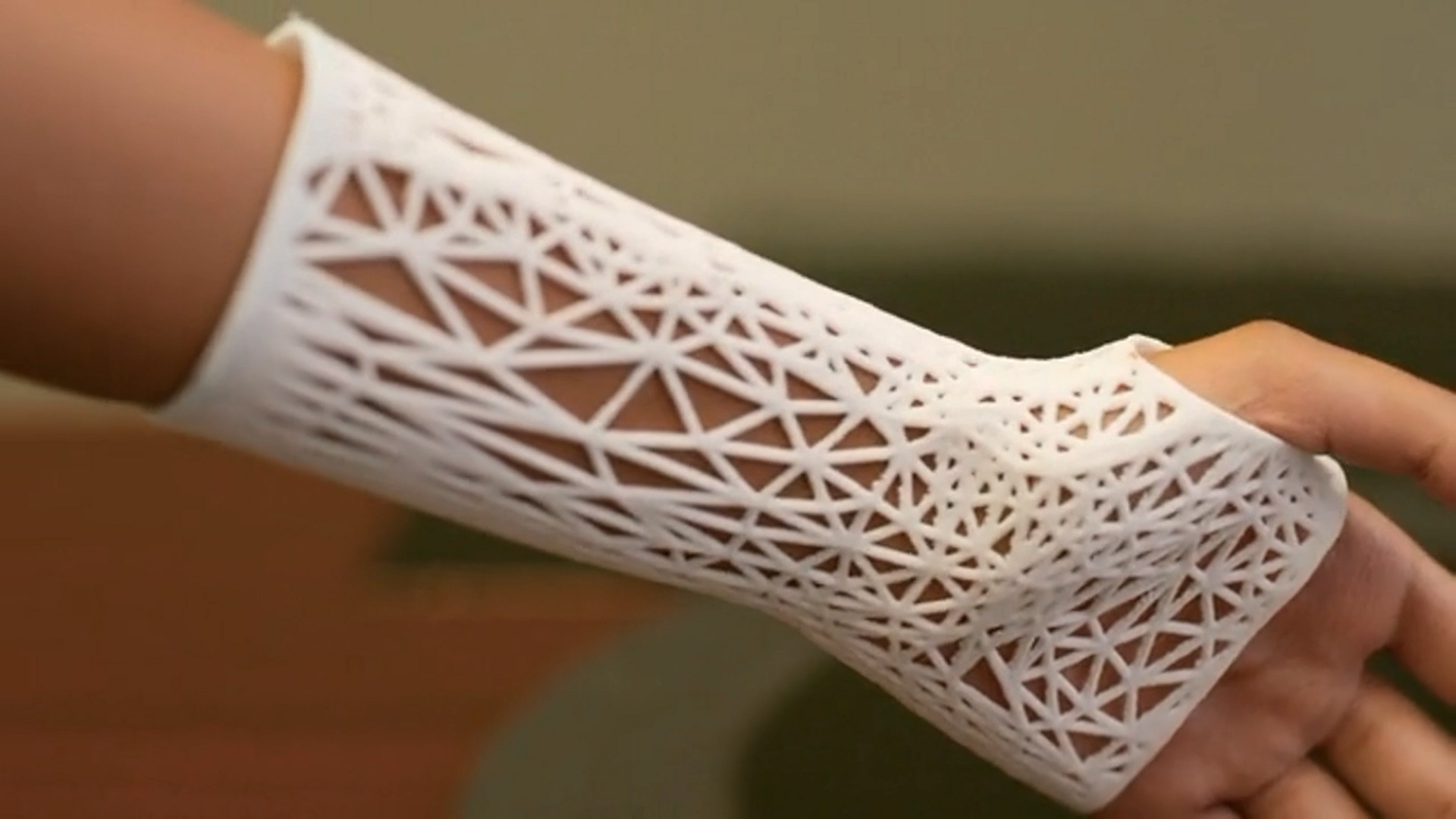 PrinterPrezz Partners with UCSF to Develop New 3D Printed Medical Devices