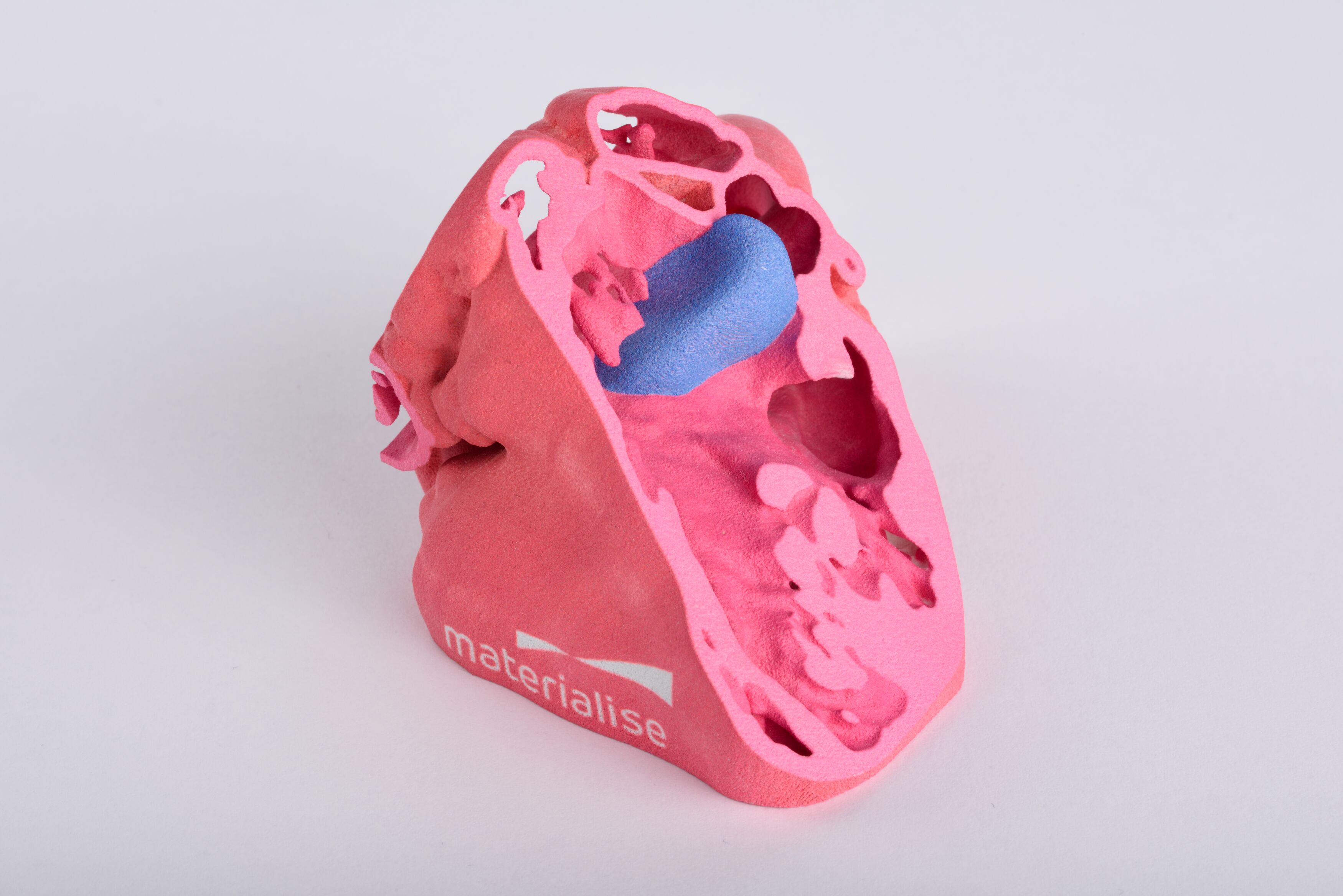 RSNA and ACR to Build 3D Printing Clinical Data Registry