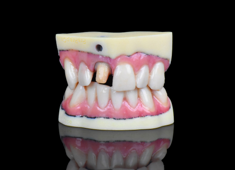 Stratasys J720 Dental brings full-color ultra-realistic models to dental industry