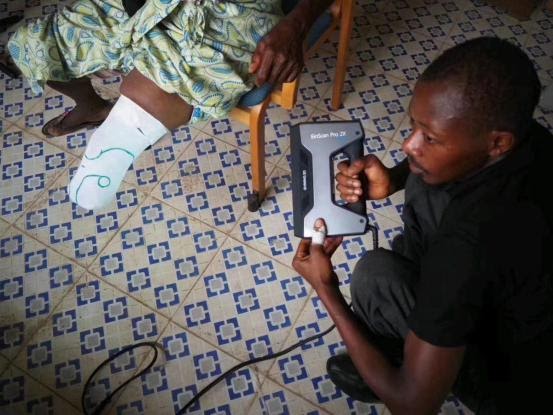 3D Sierra Leone Provides Prostheses to Amputees with Support from SHINING 3D