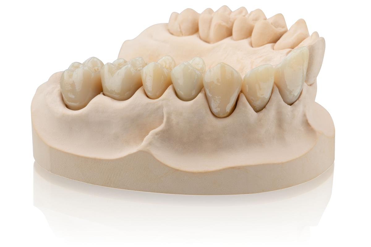 Formlabs and BEGO Announce Partnership to Advance Temporary and Permanent Dental Restorations