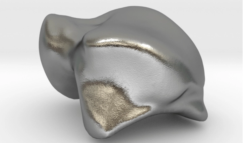 FDA Approves First Patient-Specific, 3D Printed Talus Implant in the US