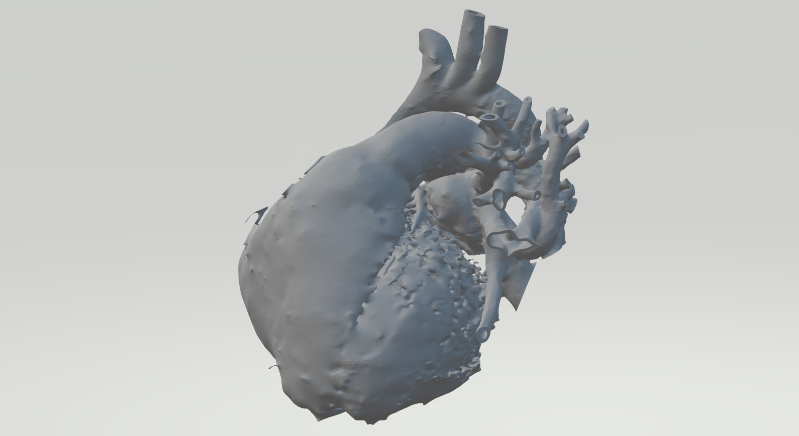 Will Support Structures Make or Break These 3D Printed Hearts?