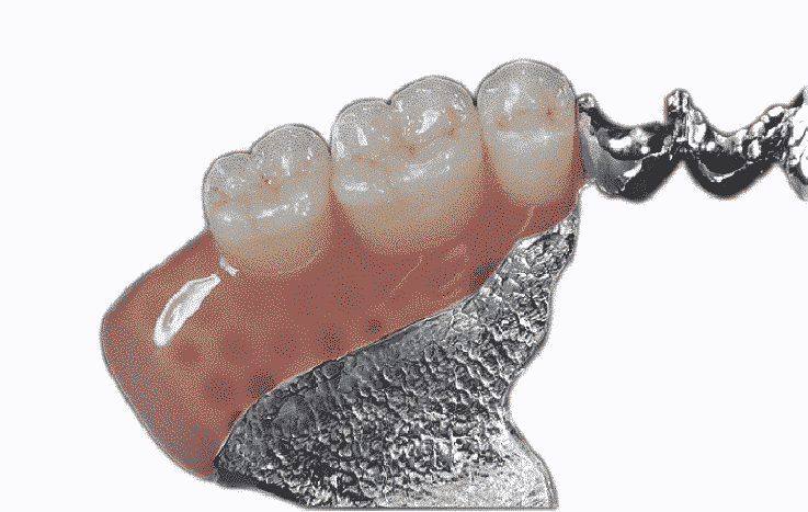 10 Applications of 3D Printing in Dentistry