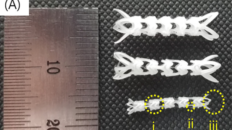 POSTECH scientists 3D print stents to combat radiation-induced espophigitis in cancer patients