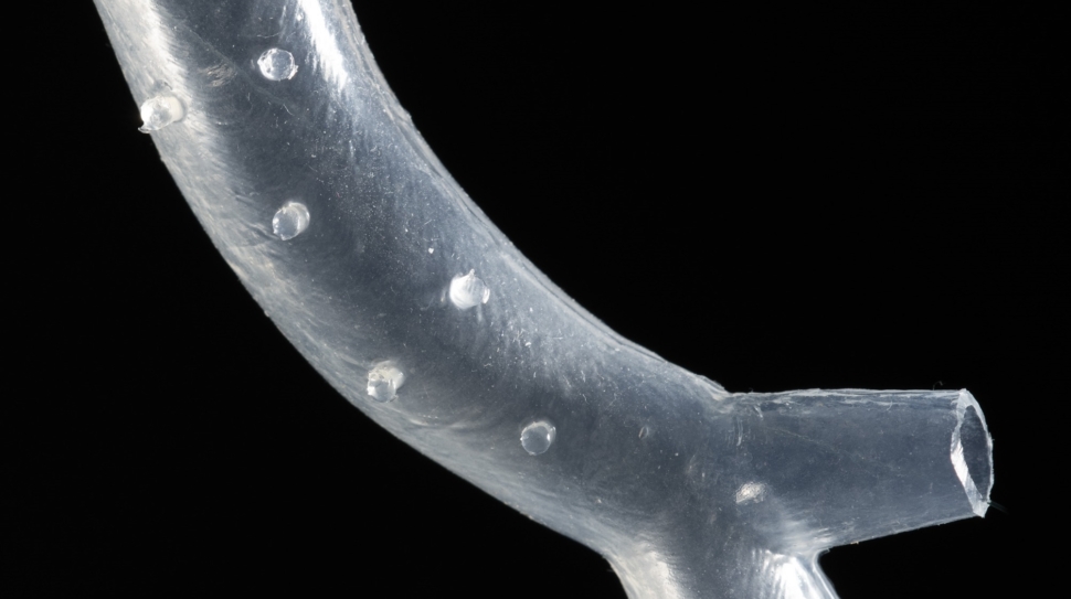 3D Printed Patient-specific Airway Stents Receive FDA Approval
