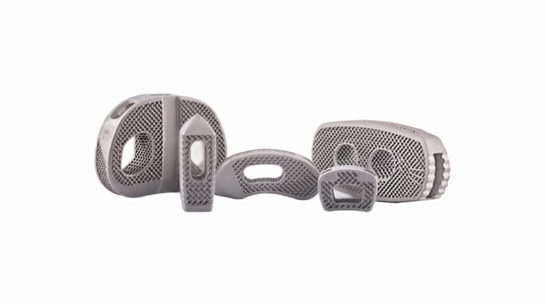 DePuy Synthes Expands 3D Printed Titanium Implant Portfolio