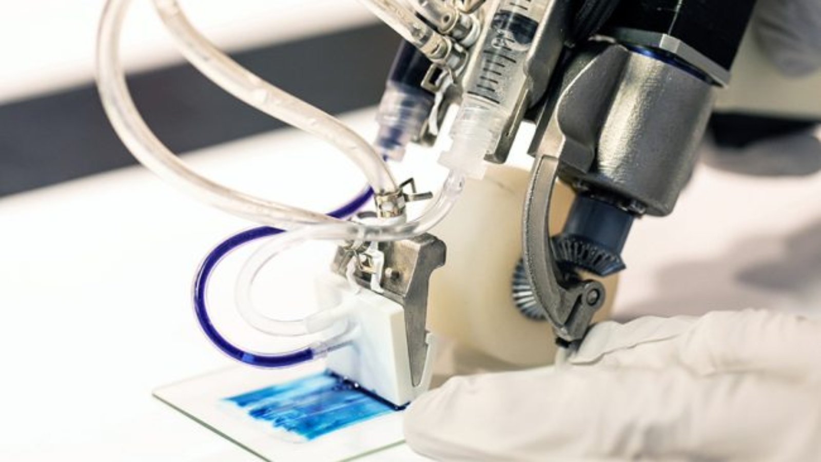 Researchers Develop Handheld 3D Bioprinter for Treating Large Skin Burns