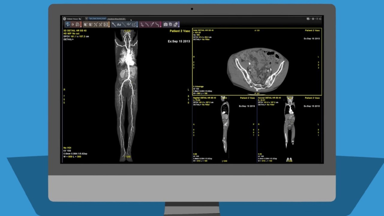 GE Healthcare Selects Formlabs as Anatomical Model 3D Printing Partner in Hospitals