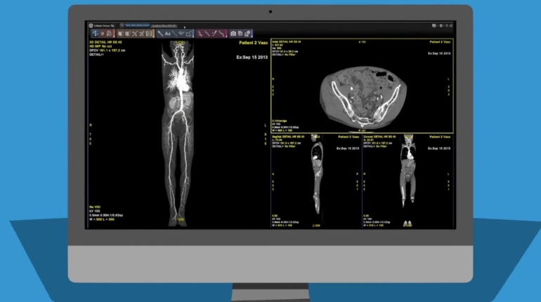 GE Healthcare Selects Formlabs as Anatomical Model 3D Printing Partner in Hospitals