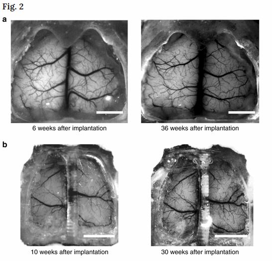 University of Minnesota Develops Transparent Skull for Mice Using 3D Printing