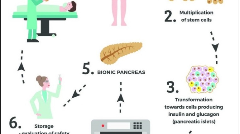 Poland Researchers to 3D Bioprint Bionic Pancreas to Combat Diabetes
