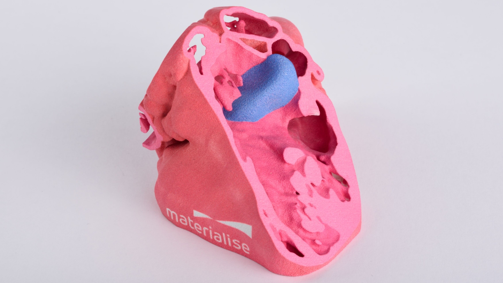 RSNA and ACR to Build 3D Printing Clinical Data Registry