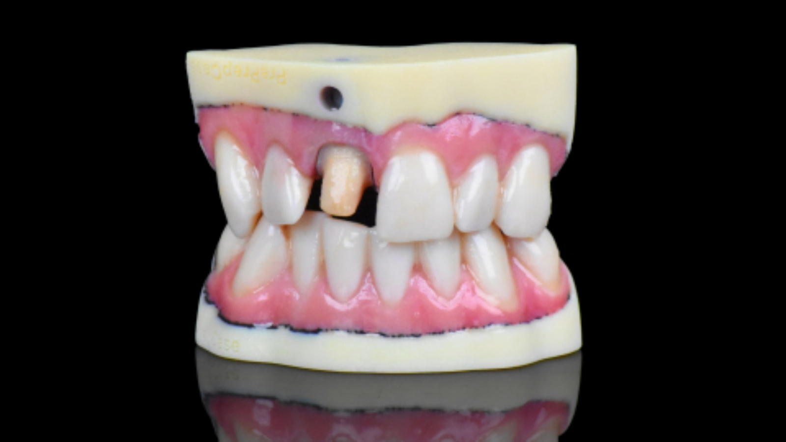 Stratasys J720 Dental brings full-color ultra-realistic models to dental industry