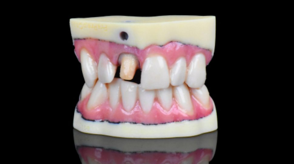 Stratasys J720 Dental brings full-color ultra-realistic models to dental industry