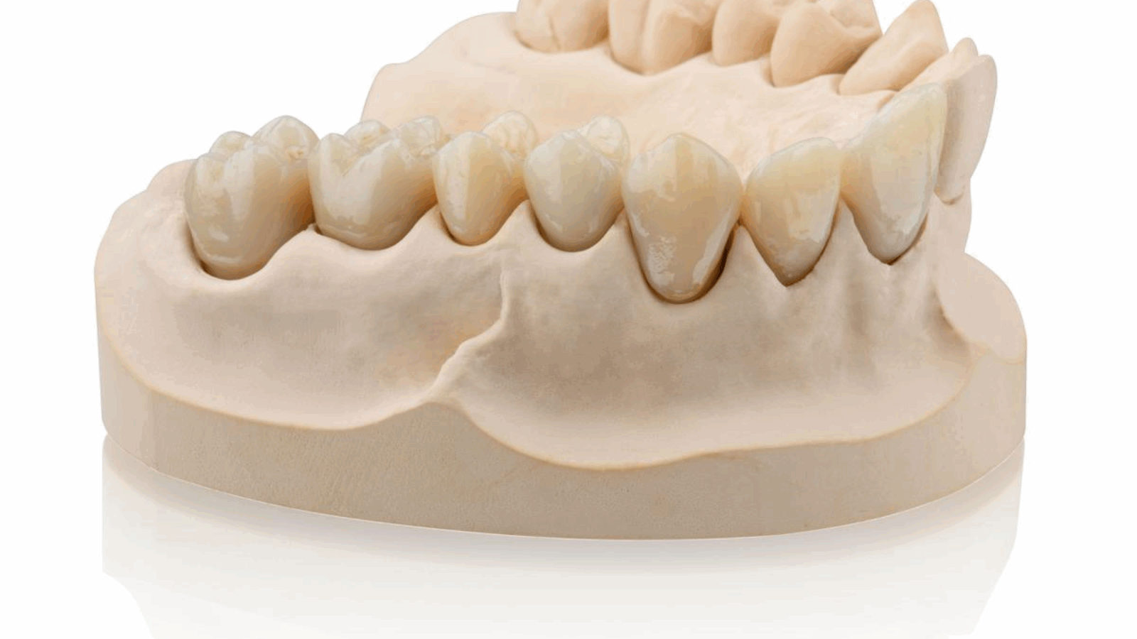 Formlabs and BEGO Announce Partnership to Advance Temporary and Permanent Dental Restorations