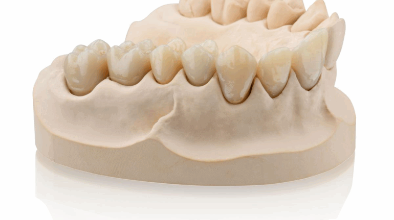Formlabs and BEGO Announce Partnership to Advance Temporary and Permanent Dental Restorations