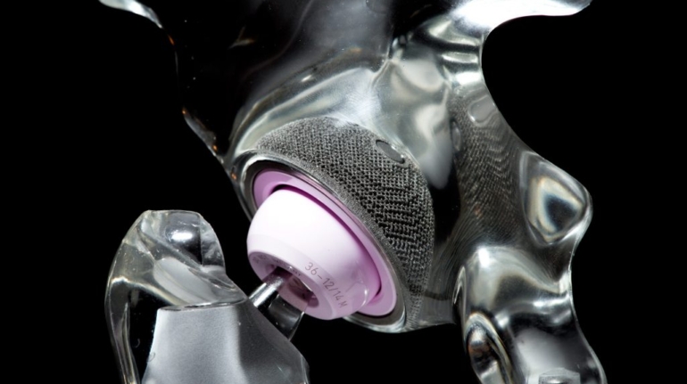 Health Canada Aligns with FDA Guidance for 3D Printed Medical Devices