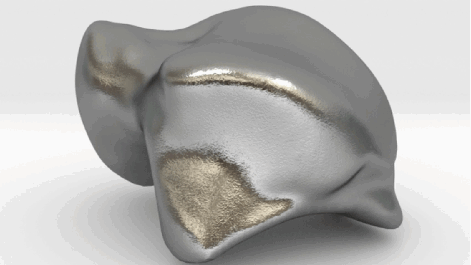 FDA Approves First Patient-Specific, 3D Printed Talus Implant in the US