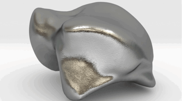 FDA Approves First Patient-Specific, 3D Printed Talus Implant in the US