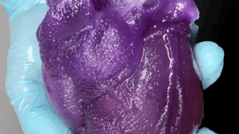 This Squishy 3D-Printed Human Heart Feels Like the Real Thing