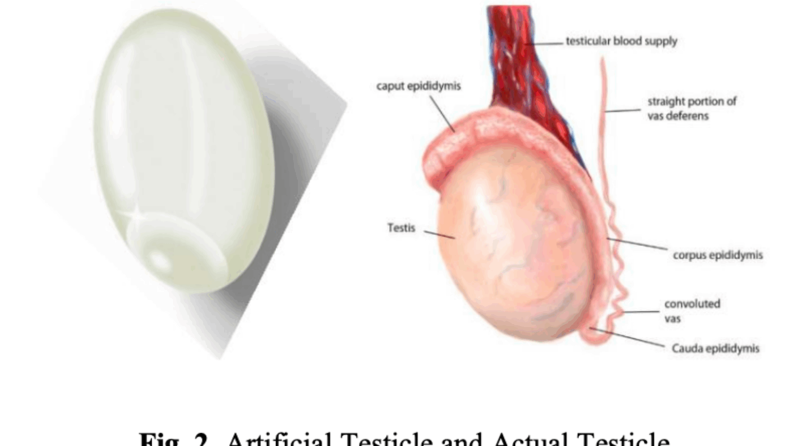 Korean Scientists Use 3D Printer to Create Low-cost Patient-specific Prosthetic Testicles
