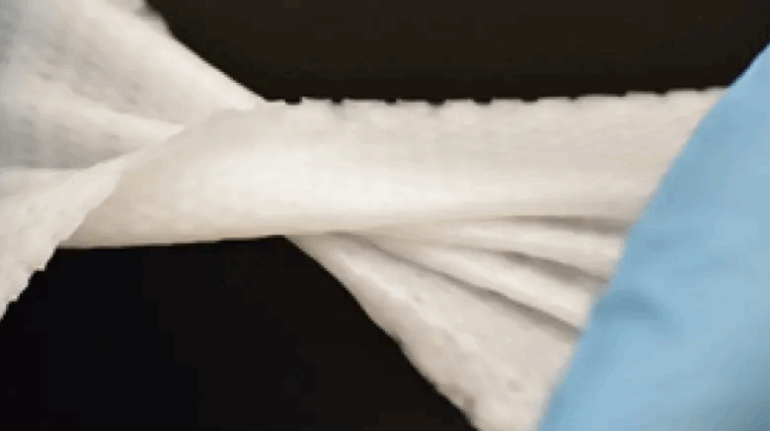 3D Bioprinted Biomesh Minimizes Hernia Repair Complications
