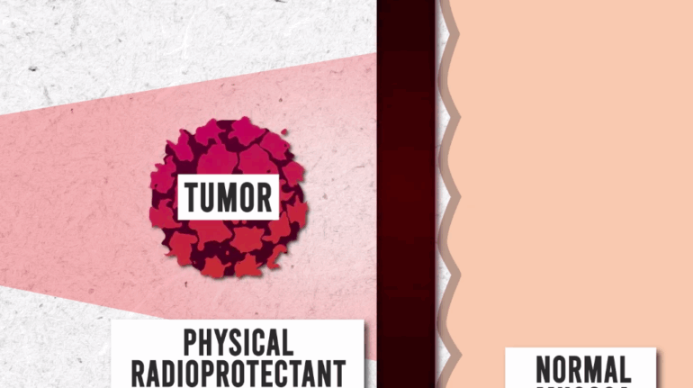Clinicians 3D Print Customized Gastro-Radiation Shielding for Cancer Patients