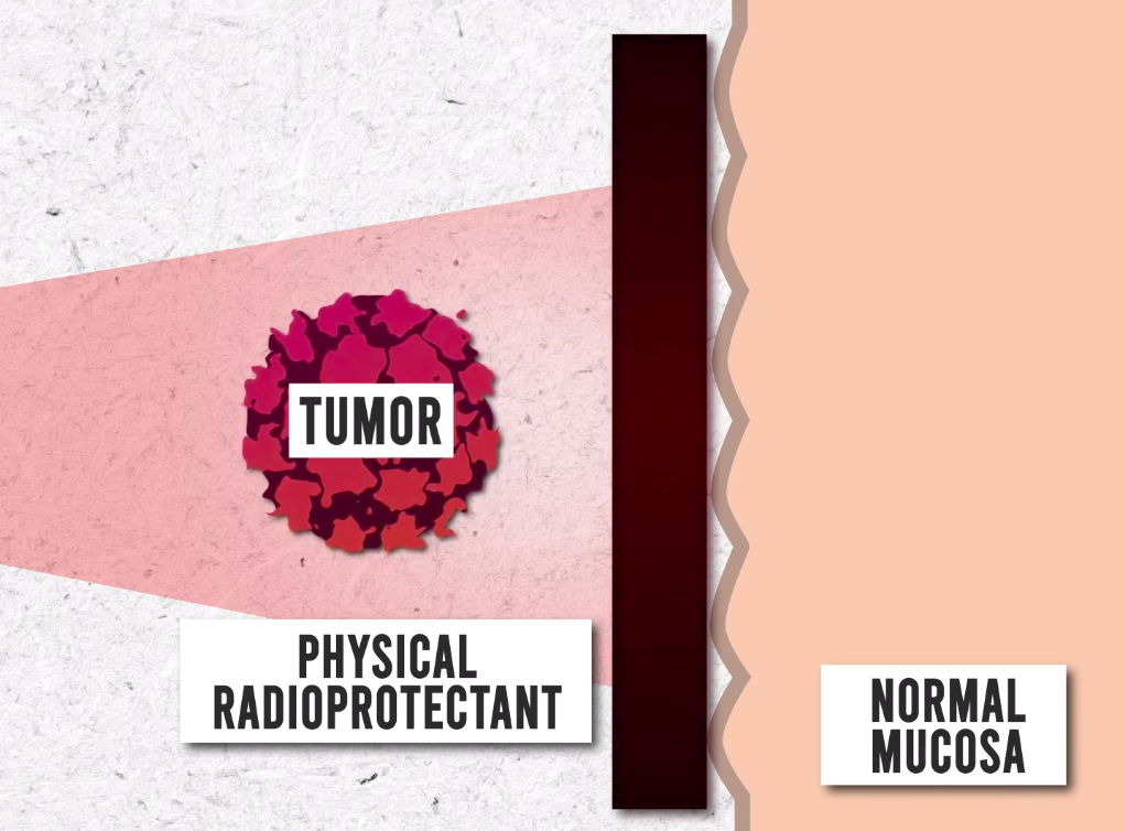 Clinicians 3D Print Customized Gastro-Radiation Shielding for Cancer Patients