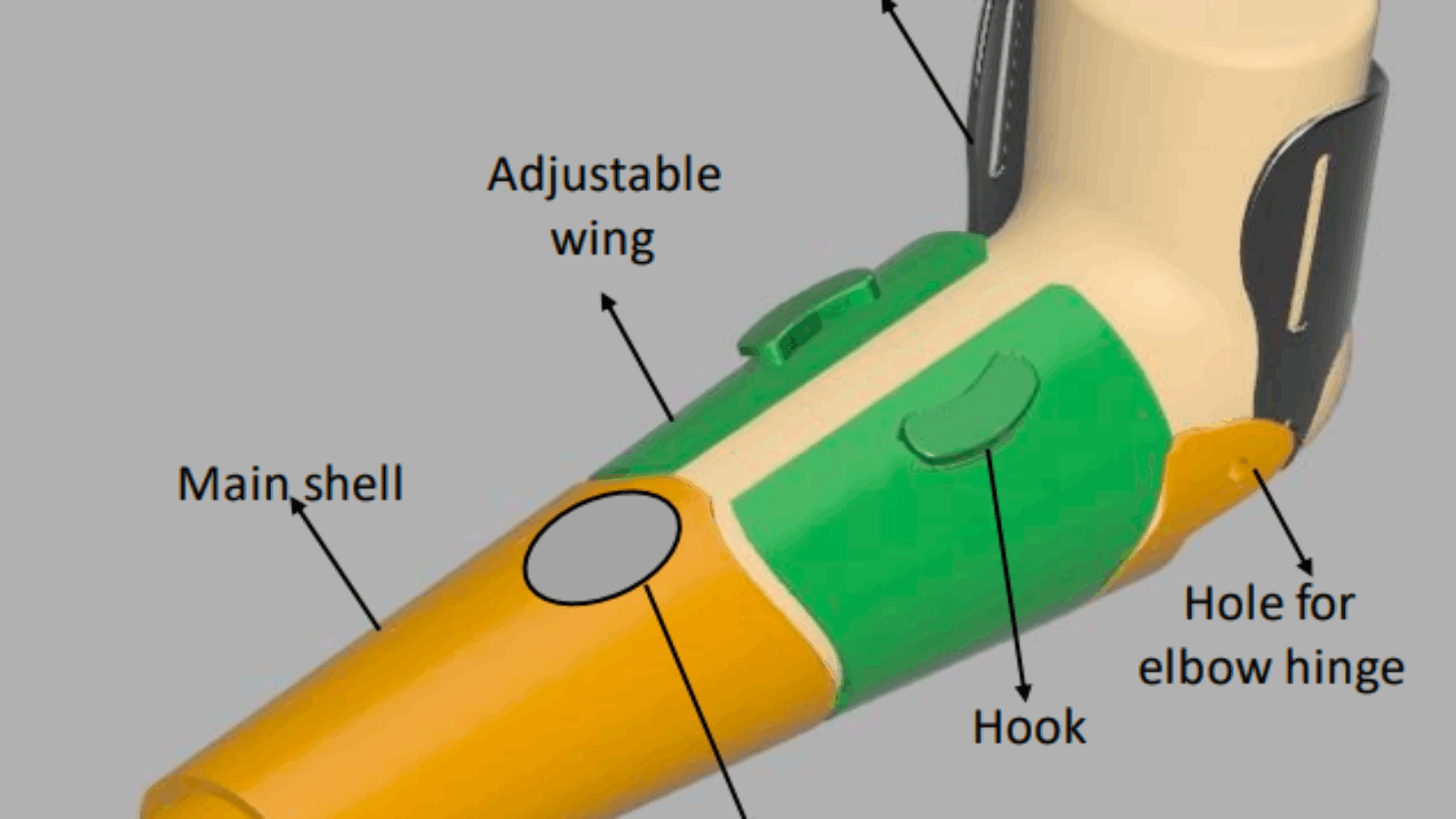 Student Engineer’s New ‘V3D’ Prosthetic Limb Socket Can Be 3D Printed for Just €30