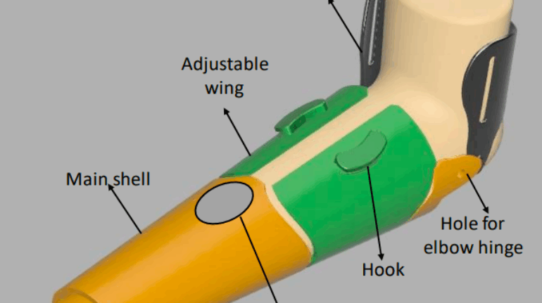 Student Engineer’s New ‘V3D’ Prosthetic Limb Socket Can Be 3D Printed for Just €30