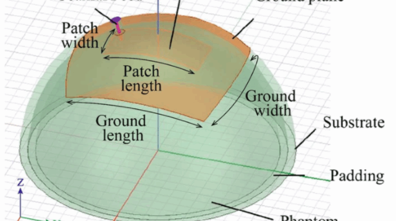 Scientists 3D Print New and Improved Breast Cancer-treating Radiotherapy Antennas