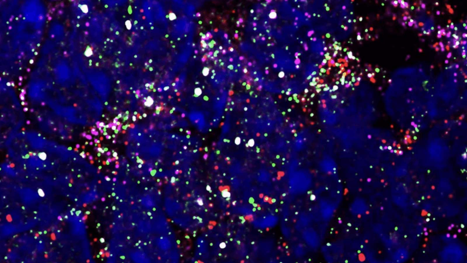Pixelbio’s 3D Printed Molecular Biochips Unlock Rapid Disease Diagnosis