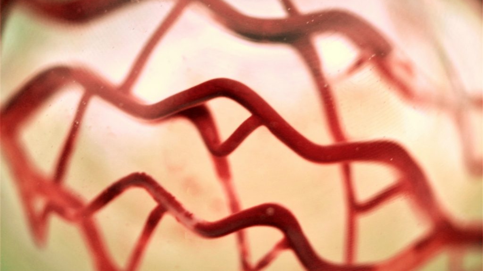 3D Systems and CollPlant Set to Use 3D Bioprinting Technology to Treat Breast Cancer Survivors