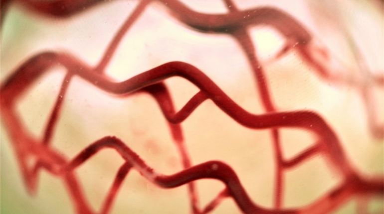 3D Systems and CollPlant Set to Use 3D Bioprinting Technology to Treat Breast Cancer Survivors