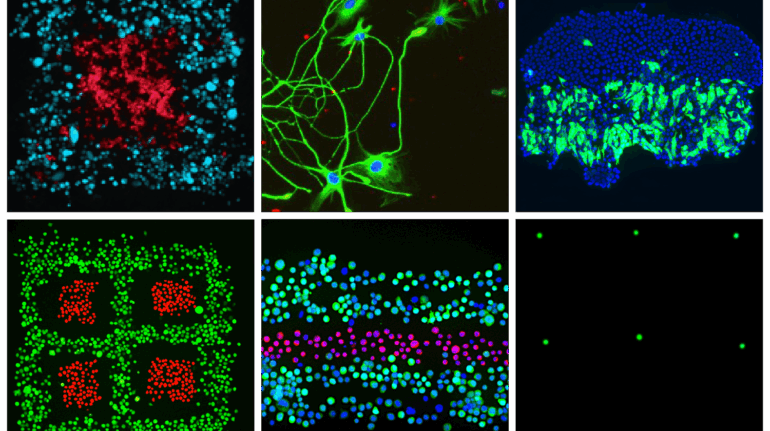 Fluicell Partners with Swedish Researchers to 3D Bioprint Complex Brain Cell Structures