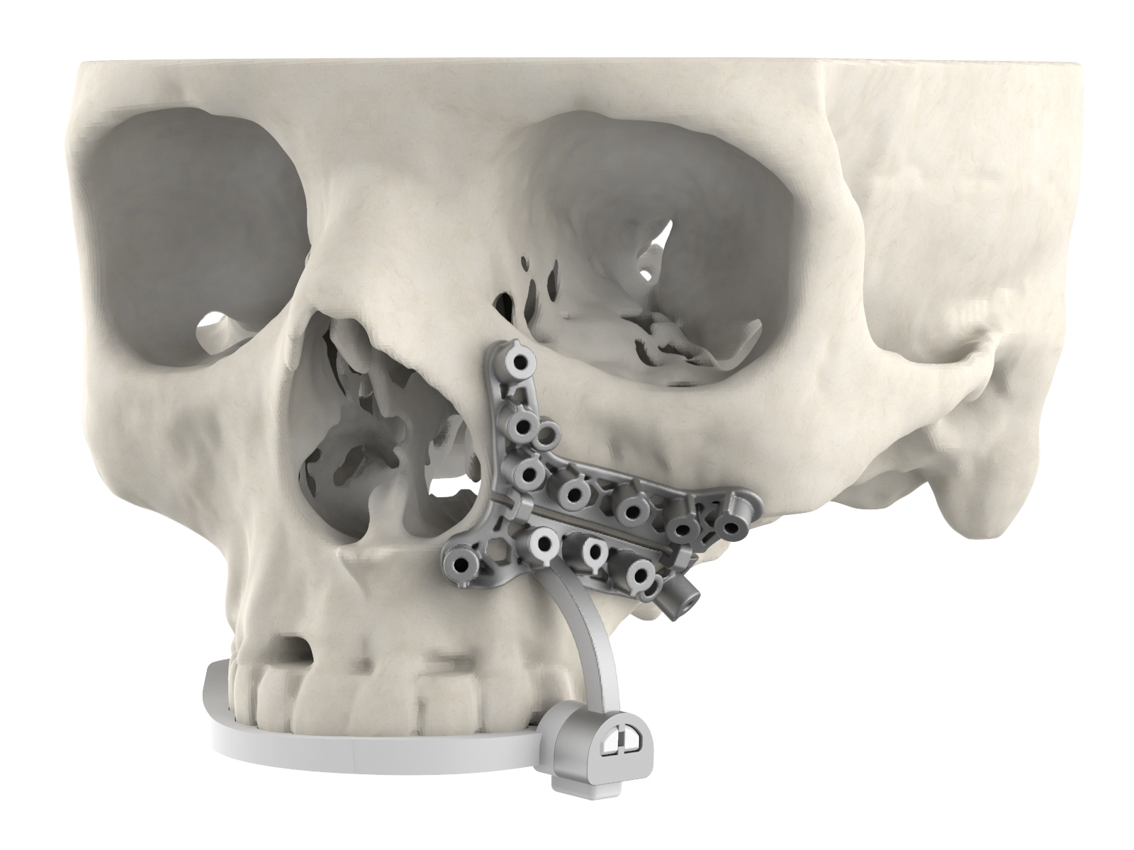 3D Systems and Enhatch partner to scale delivery of 3D printed medical devices