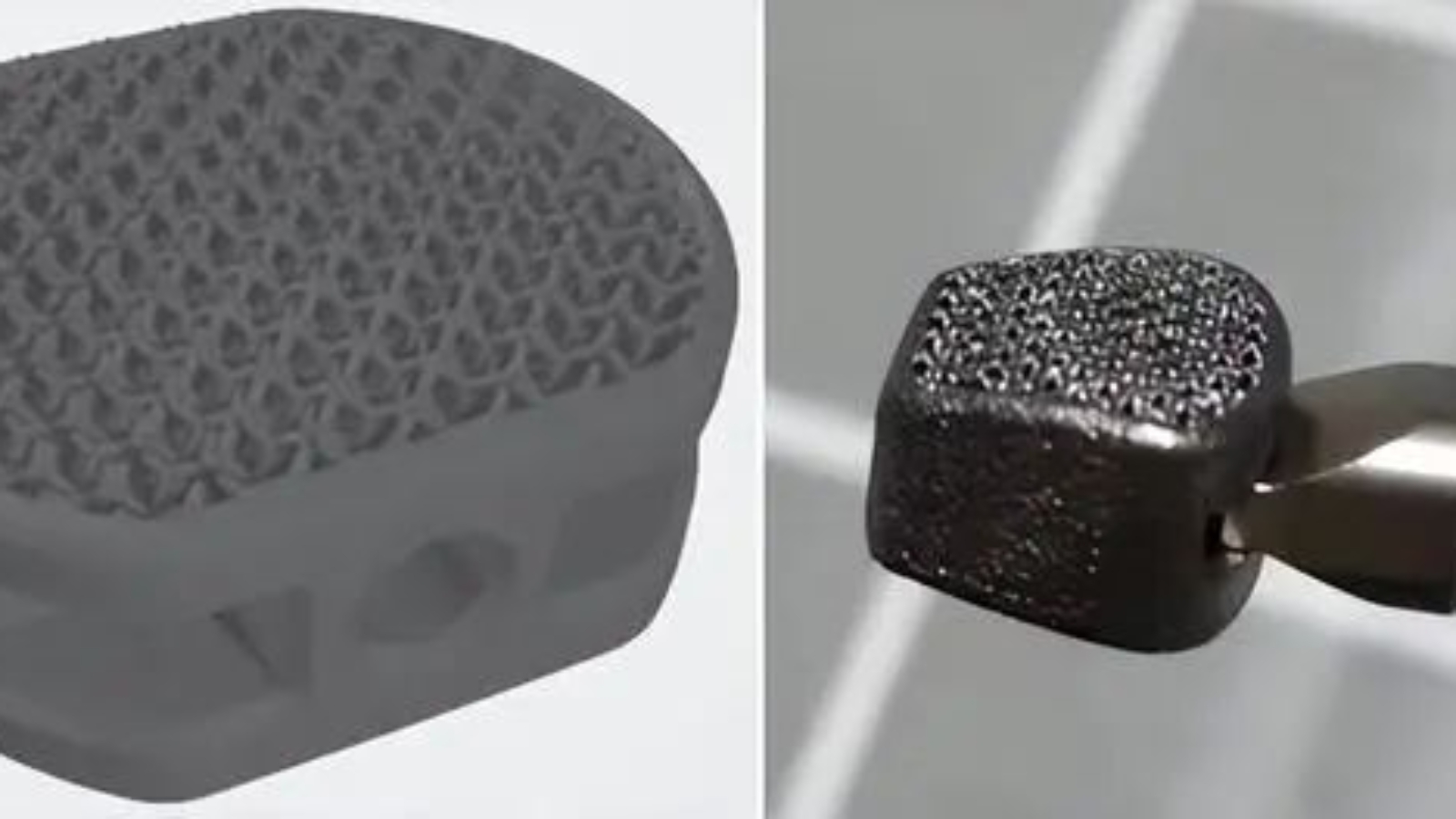 3 Striking Real Cases of Metal 3D Printing in Surgery and Medicine