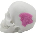 Researchers Develop 3D Printable Bio-Active Glass for Bone Repair