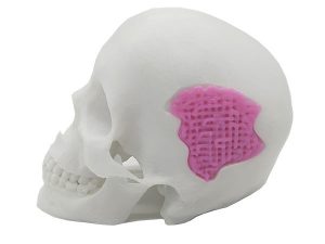 Researchers Develop 3D Printable Bio-Active Glass for Bone Repair