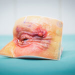 Europe’s New 3D Printed Eye Models Elevate Eyelid Surgery Practice