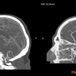 RadioMatrix: Stratasys Expands Access to Patient-Specific Radiopaque 3D Printing for Medical Imaging
