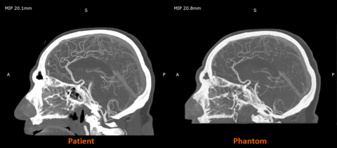 RadioMatrix: Stratasys Expands Access to Patient-Specific Radiopaque 3D Printing for Medical Imaging
