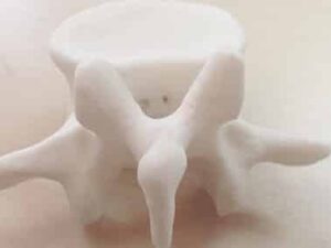 FDM Printed PLA Surgical Guide for Spine Surgery