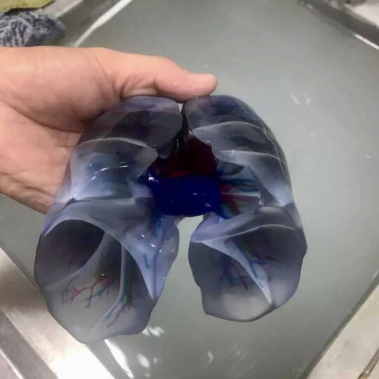 2019-nCoV infected lung model 