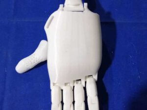 FDM 3D Printed Hand Prosthesis For Disabled People