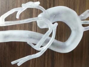 SLA 3D Printed Translucent Frosted Medical Blood Vessel Models